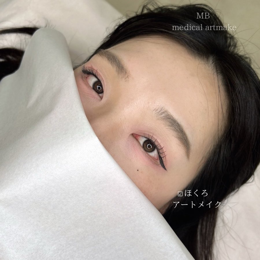 目尻のほくろアートメイクの仕上がり